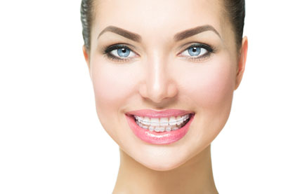 Invisalign® Clear Braces – The Solution for a Straighter Smile