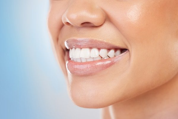 Dental Bonding And Teeth Whitening