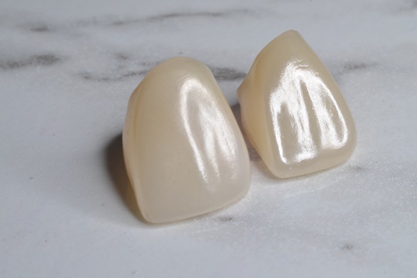 Metal Crowns vs. Porcelain Dental Crowns - Arc Advanced Dentistry ...